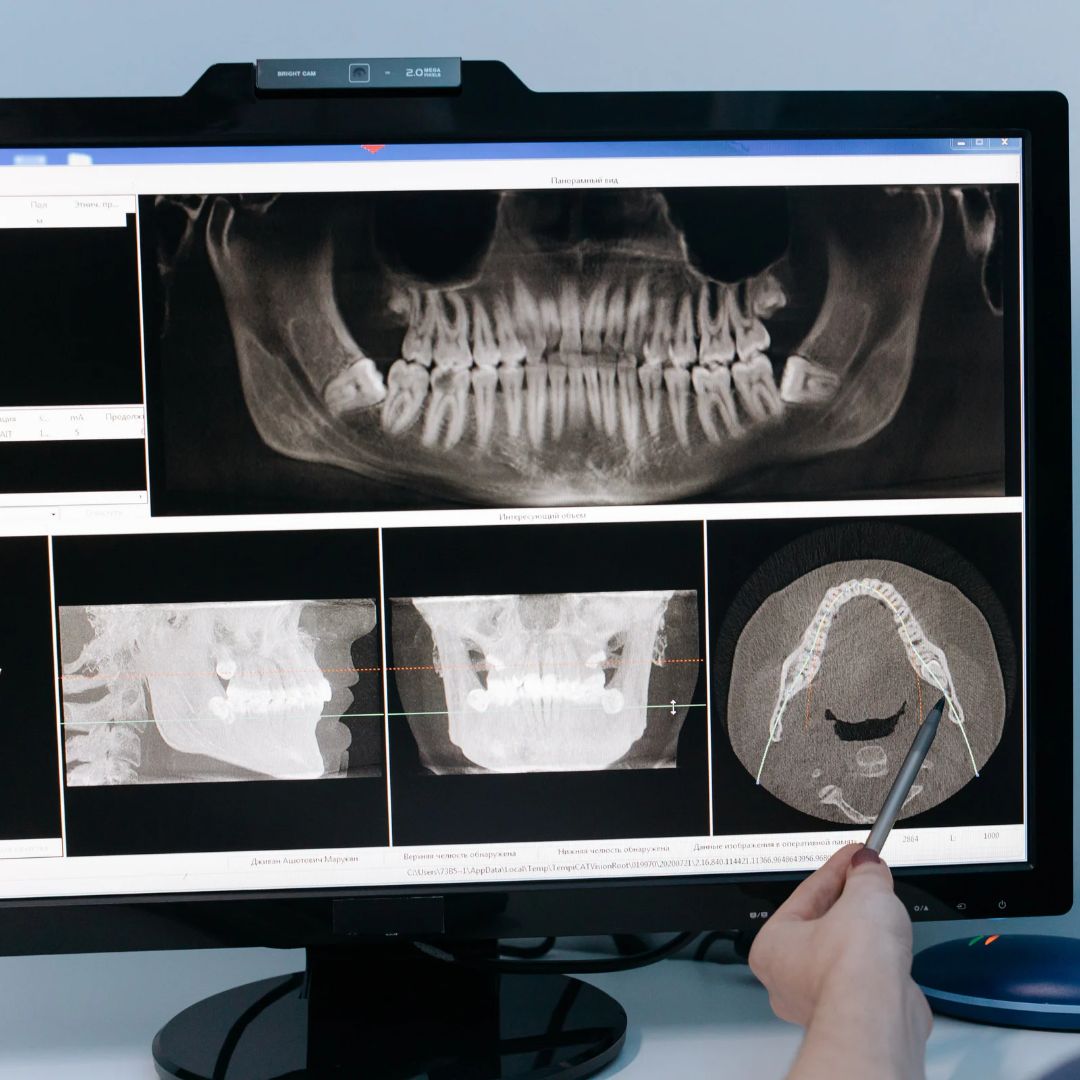 Diagnostica-dentale